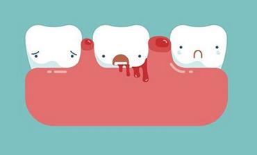 常见的损害牙齿的行为有哪些
